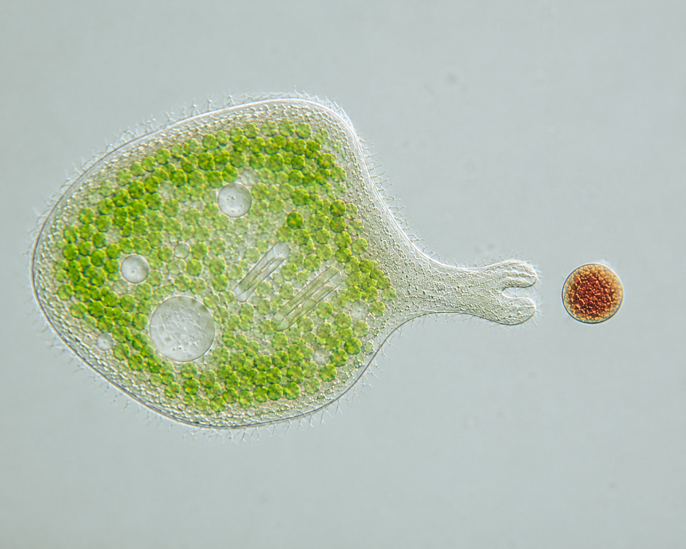 A unicellular organism deforms and extends its body (pseudopod) to capture food.
